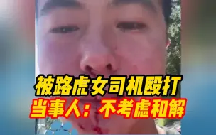 Download Video: 被青岛插队路虎女司机殴打致口鼻出血男子发声：不考虑和解