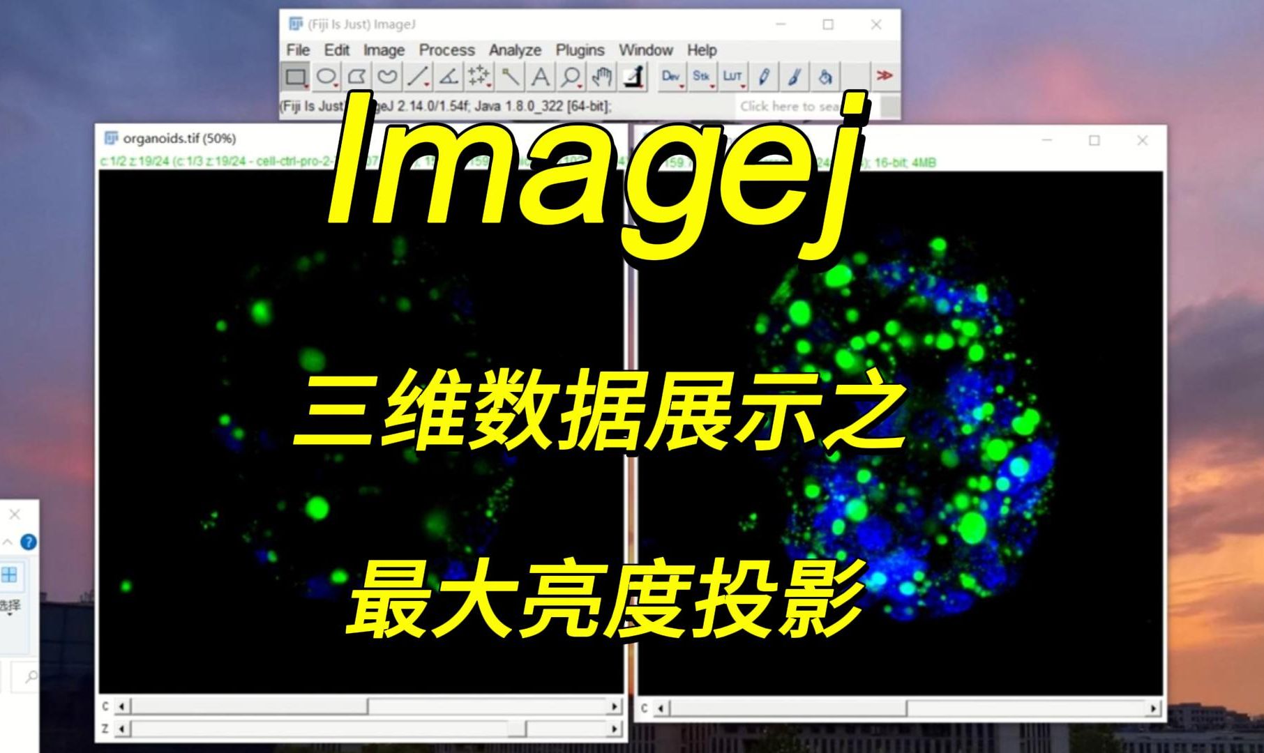 Imagej 三维数据展示之最大亮度投影哔哩哔哩bilibili