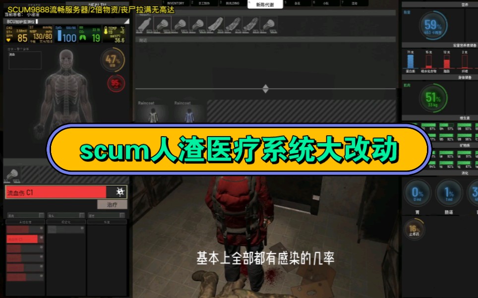 Scum新版医疗系统/大幅增加感染几率!逛地堡要多备老爹苦艾酒和异丙醇了网络游戏热门视频