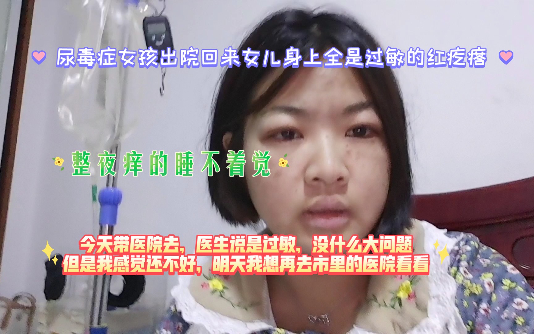 尿毒症女孩讲述自己不是一个合格的母亲,住院半个月回来女儿身上全是过敏的疙瘩,整夜痒的睡不着今天带医院去看了,说是过敏,明天再去市里看看,...