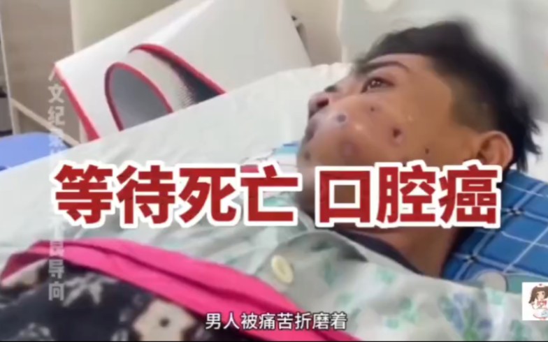 [图]口腔癌中晚期，只能等待死神的降临。