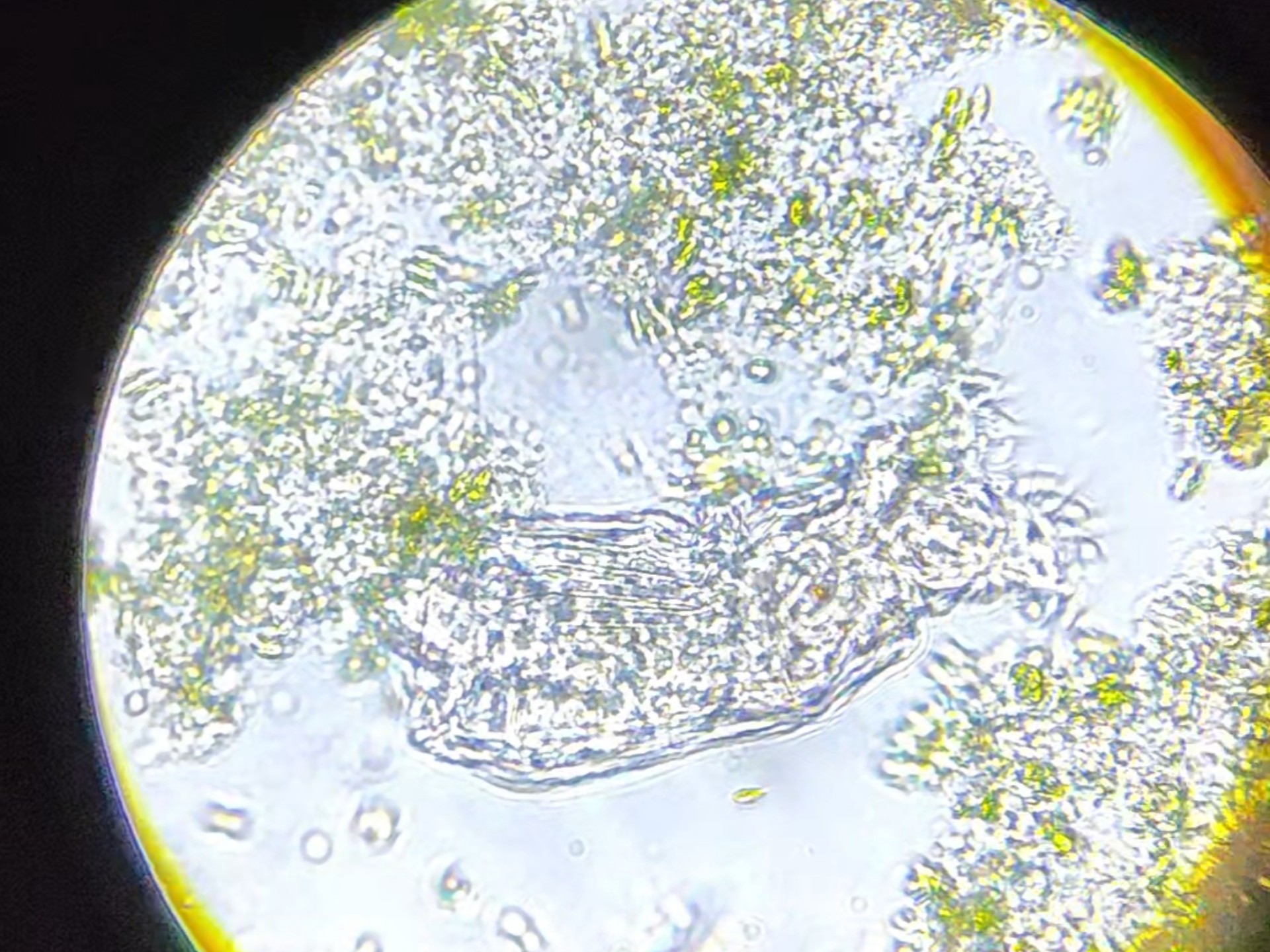 用最新自制的显微镜,观察水中的轮虫