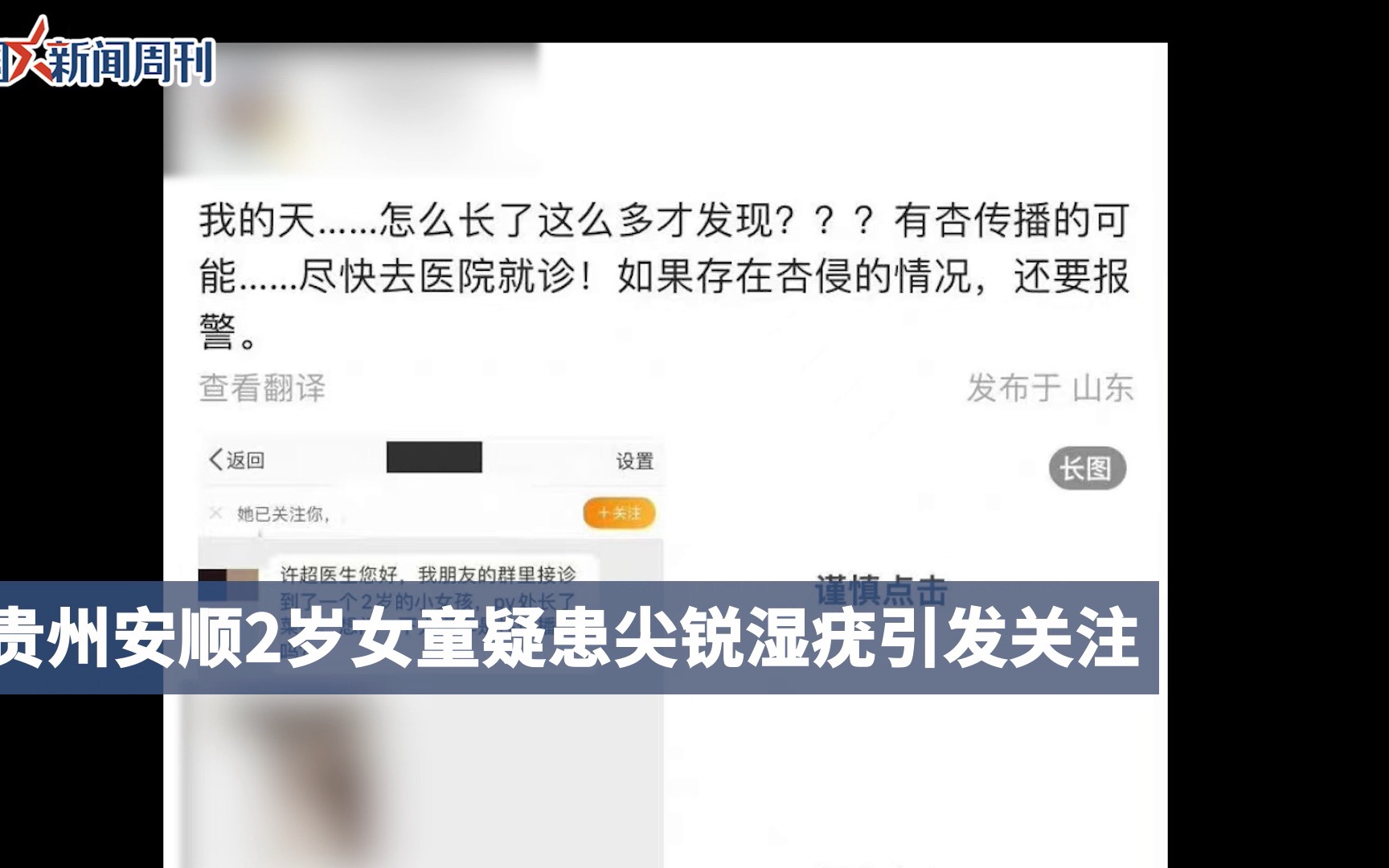 妇联回应2岁女童疑患尖锐湿疣:女童已得到治疗哔哩哔哩bilibili