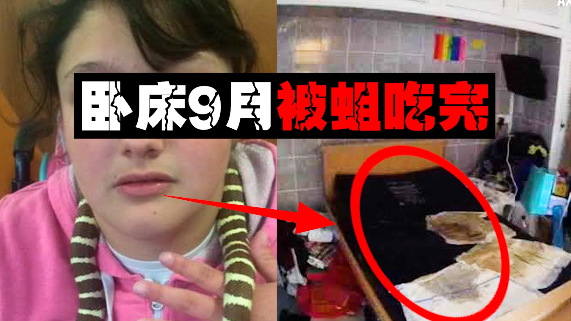 【苍蝇女孩】变态父母任由女儿烂死床上，父亲说她只是感冒。。。