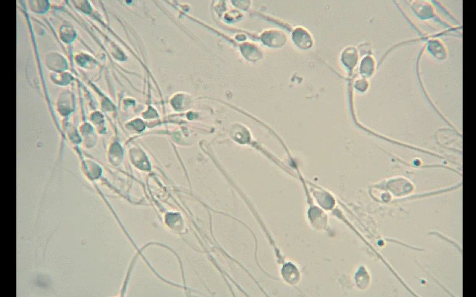 [图]我把自己的精子放在显微镜下放大1000倍看，神奇的一幕出现了@油兔不二字幕组