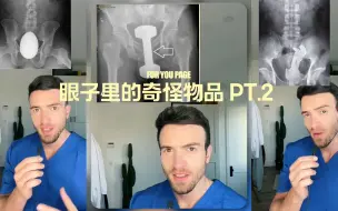 Descargar video: 那个里面的奇怪物品 PT.2