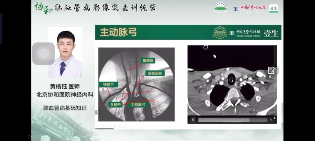 经典系列0001CTA源图像之主动脉弓“三根毛”的判别哔哩哔哩bilibili