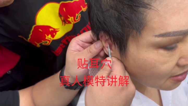 贴耳穴真人模特讲解