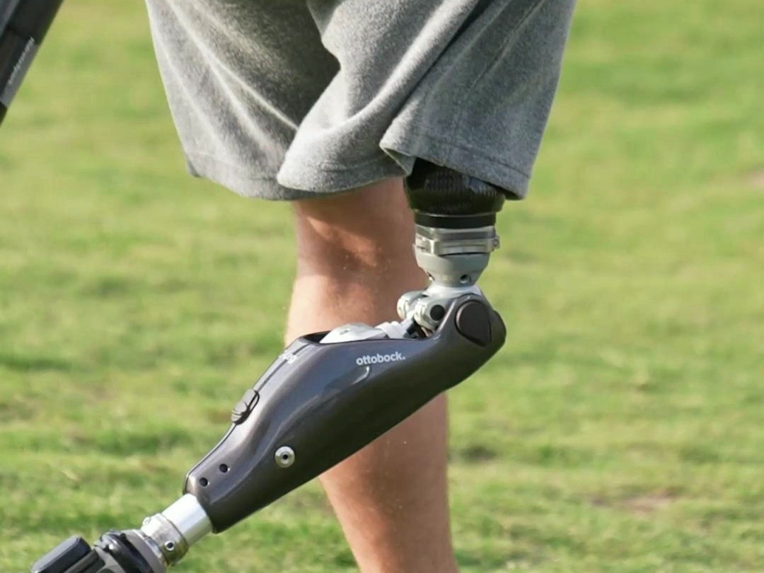 拥有陀螺仪和imu惯性单元的智能假肢,就是这么酷