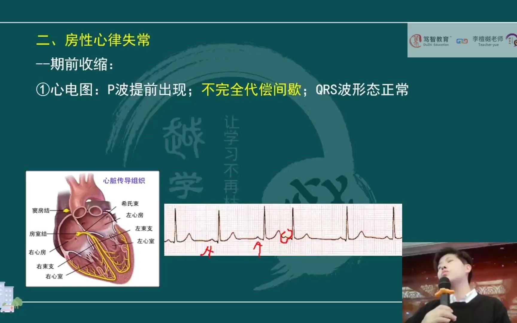 心率失常病人的护理:心率失常图解哔哩哔哩bilibili