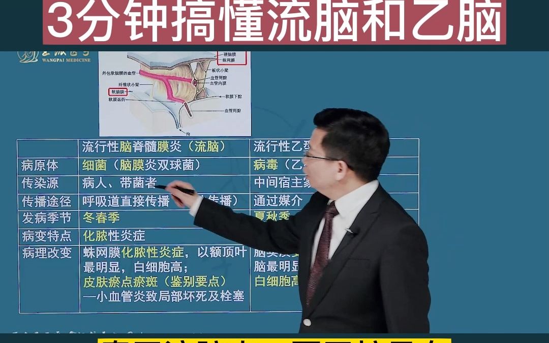 临床执业医师考试——3分钟搞懂流脑和乙脑哔哩哔哩bilibili