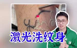 Video herunterladen: 纹身容易洗掉难！费用还要大几万！纹身前必看