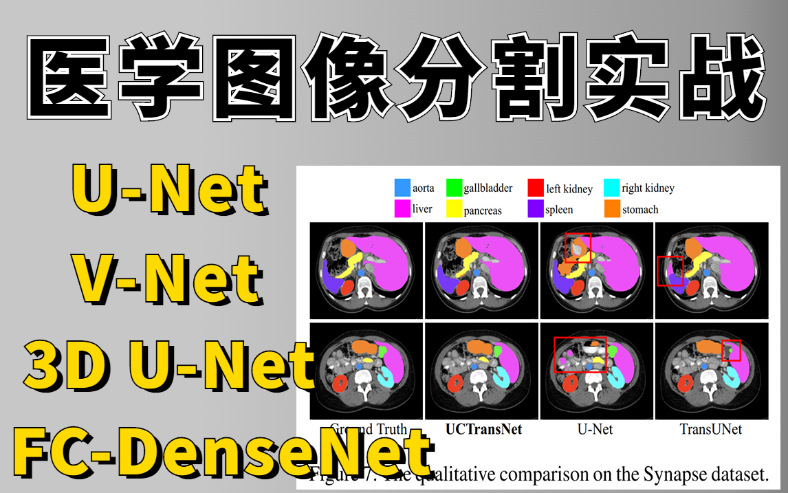 看完就能写进简历的医学图像分割实战,3D UNet\VNet\FCDenseNet全详解!上交大博士带你从零入门图像分割!哔哩哔哩bilibili