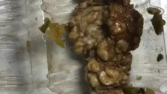 儿子在城里吃淋巴肉😭😞😭😞