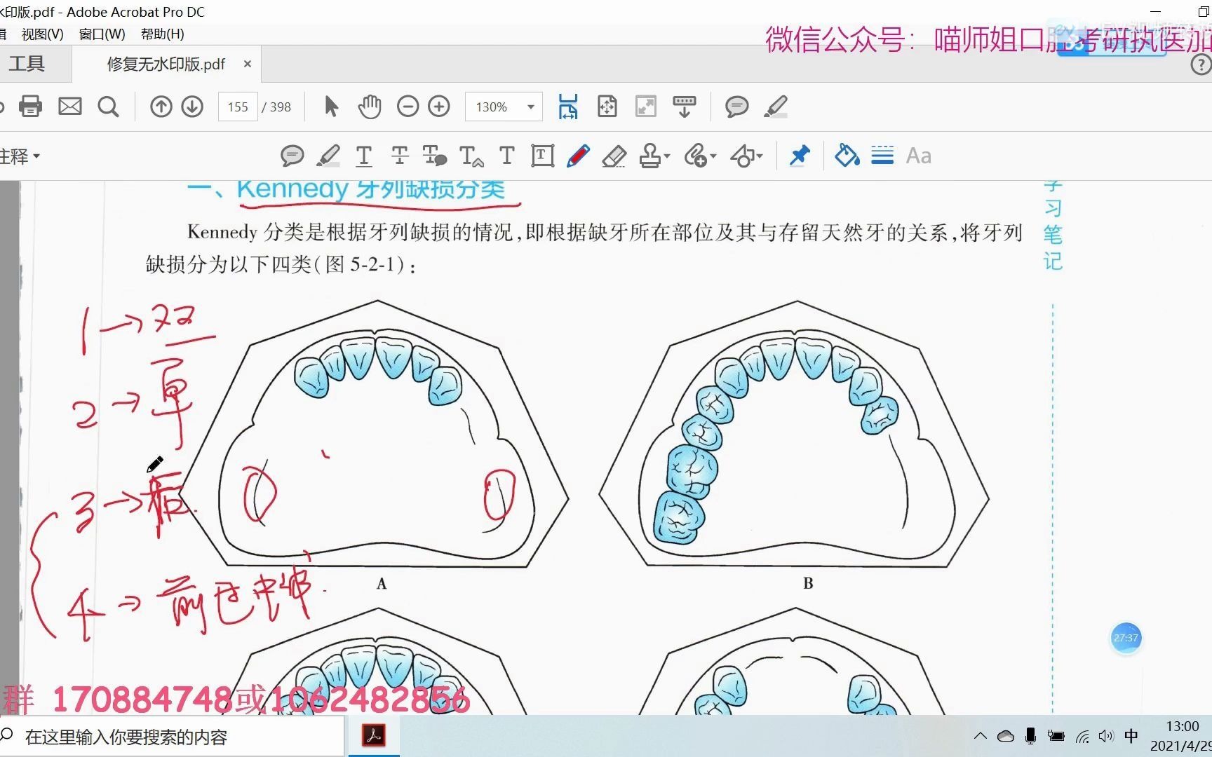 口腔修复学人卫新教材考研网课可摘局部义齿肯氏分类执业医师助理医师 喵师姐口腔哔哩哔哩bilibili