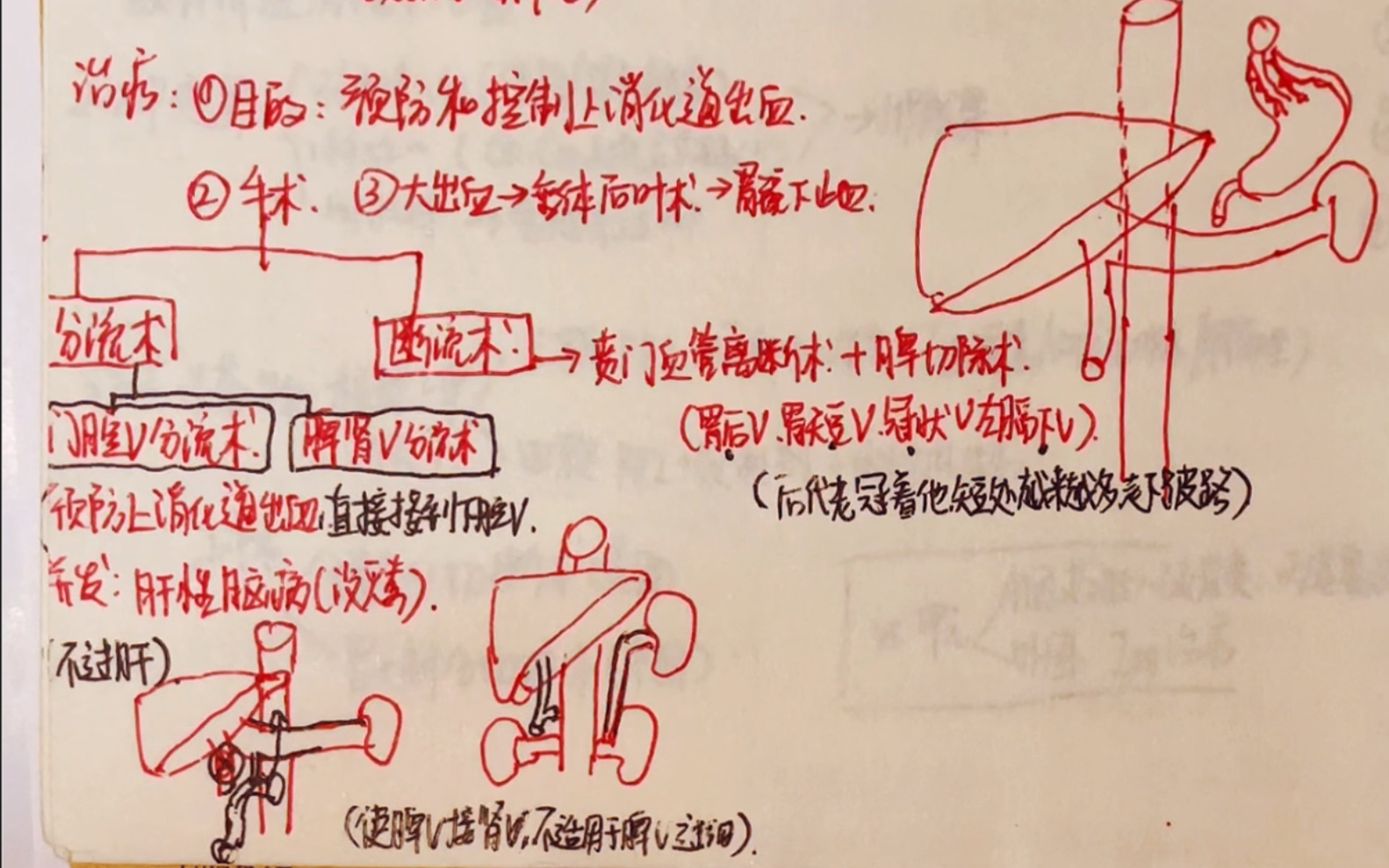 护理考研内科消化系统9门脉高压哔哩哔哩bilibili