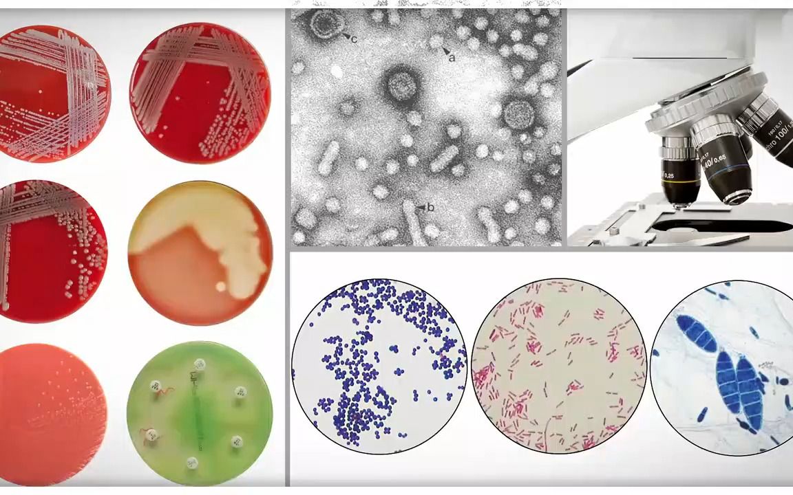 化脓性链球菌图片