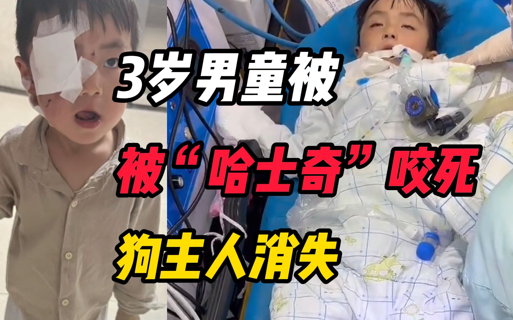 3岁男童被"哈士奇"咬伤,打了疫苗18天后离世,狗主人不见踪迹