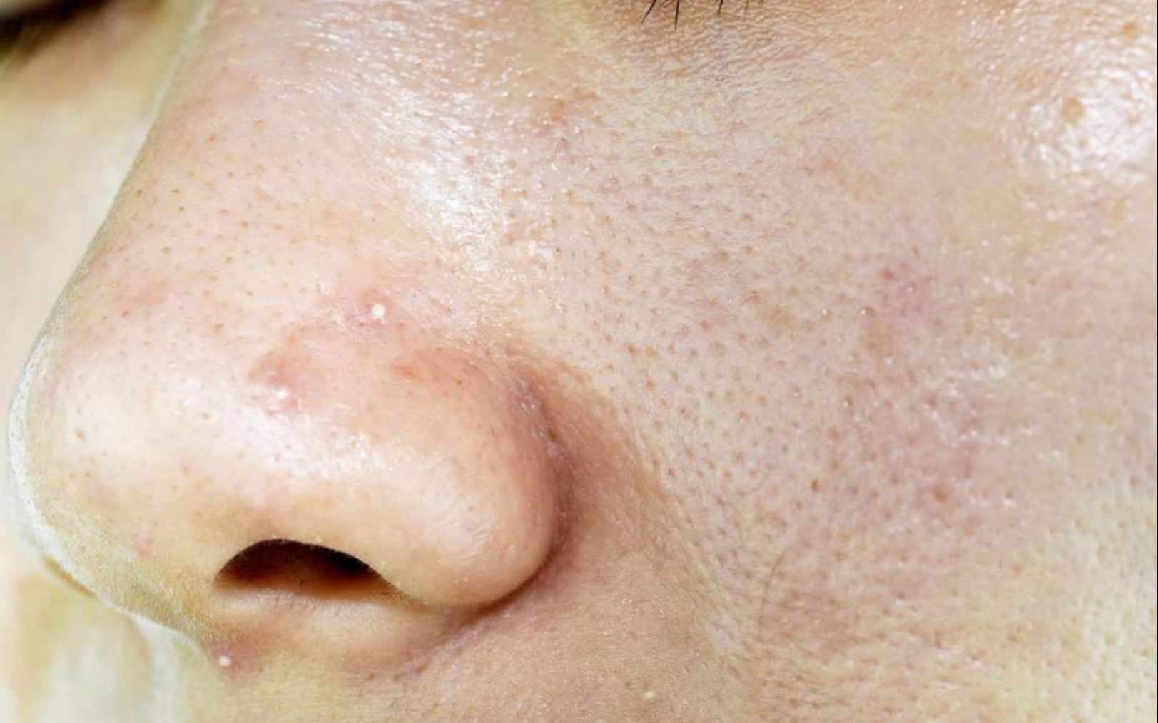 试试drdm舒润倍护霜,给你的肌肤加"猛药"!