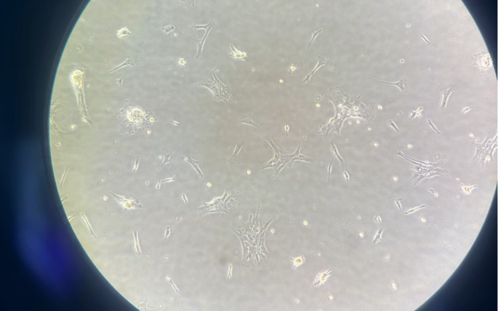 msc细胞居然还可以这样?这是我们分离的脐带原代细胞、从p0培养到p1代,图一图二p1的第三天,细胞就看起来像小手掌似的,一簇一簇的生长,图三图四...