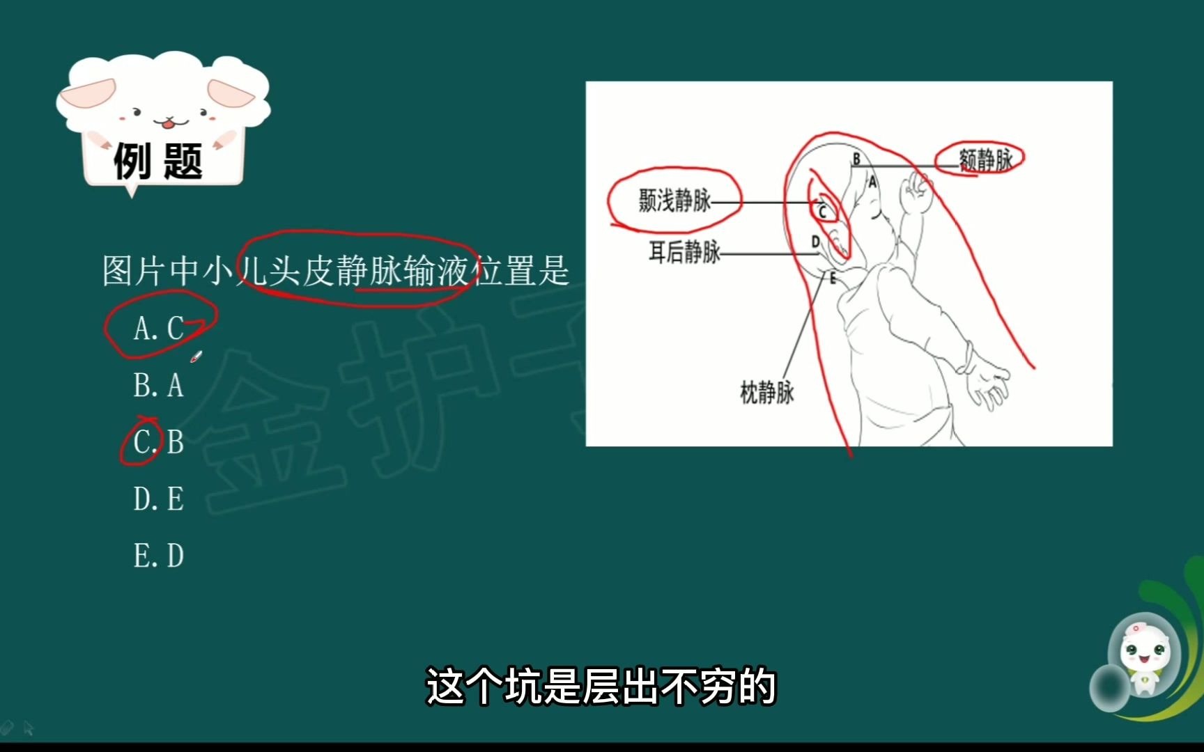 【金护子教育】一分钟快速解题,小儿头皮静脉输液的位置是?哔哩哔哩bilibili