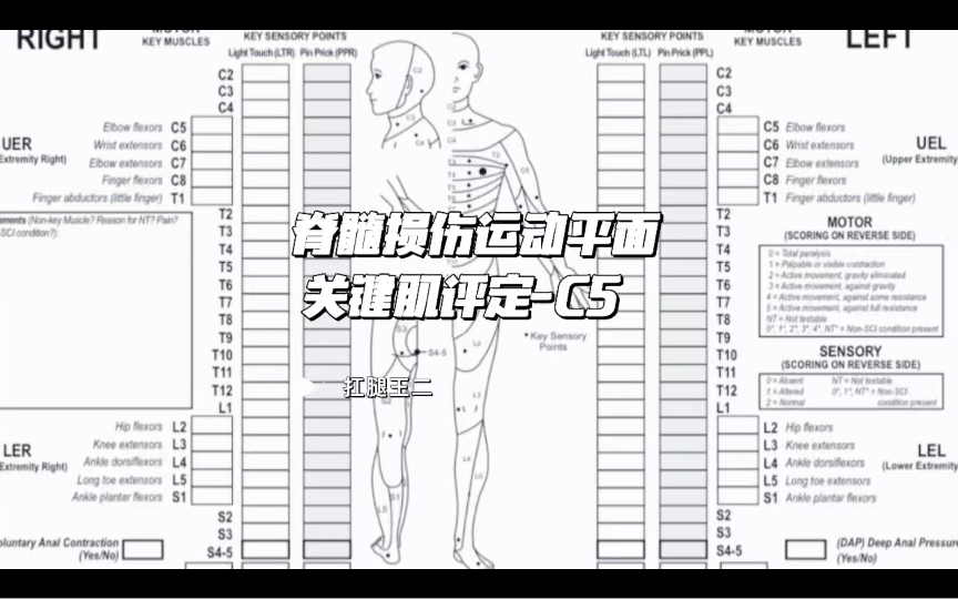 脊髓损伤ASIA运动平面关键肌C5肌力评定哔哩哔哩bilibili