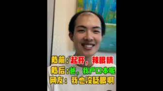 你的秃头小宝贝