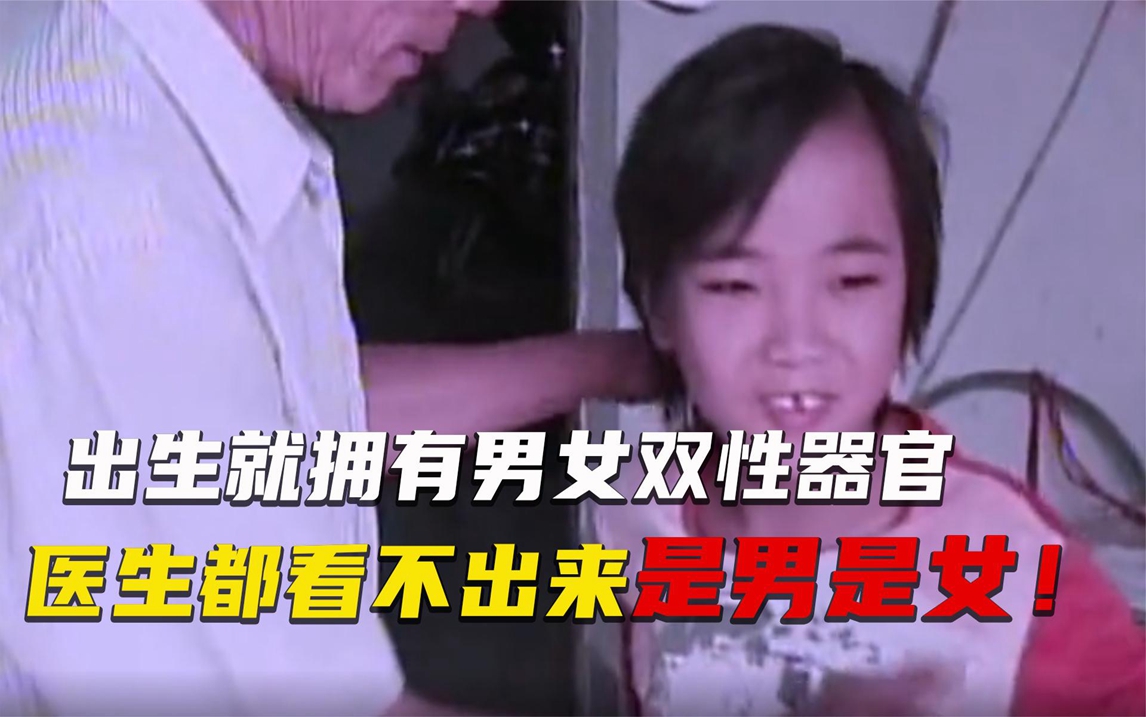 出生就是双性人,同时拥有男女两性器官,医生都难辨雌雄,纪录片