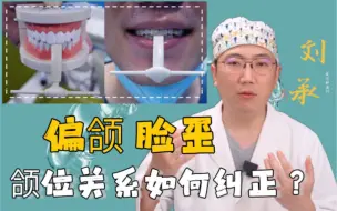 Download Video: 偏颌脸歪颌位关系如何纠正？