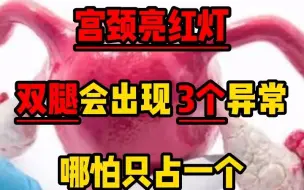 Download Video: 宫颈亮红灯，双腿会出现3个异常，哪怕只占一个，也要去检查HPV