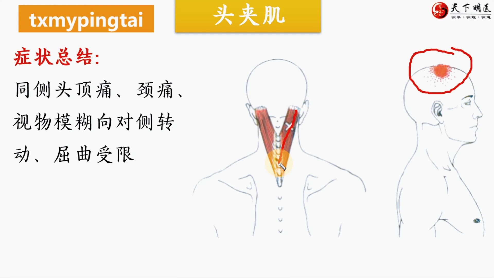 头颈夹肌起止点图片