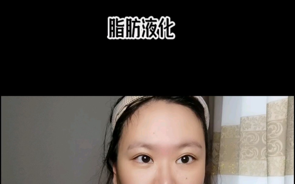 脂肪液化哔哩哔哩bilibili