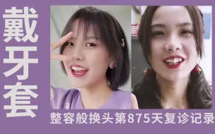 Tải video: 戴隐适美牙套875天，超过100副还没摘？医生到底在给我调整些什么？丨正畸复诊记录