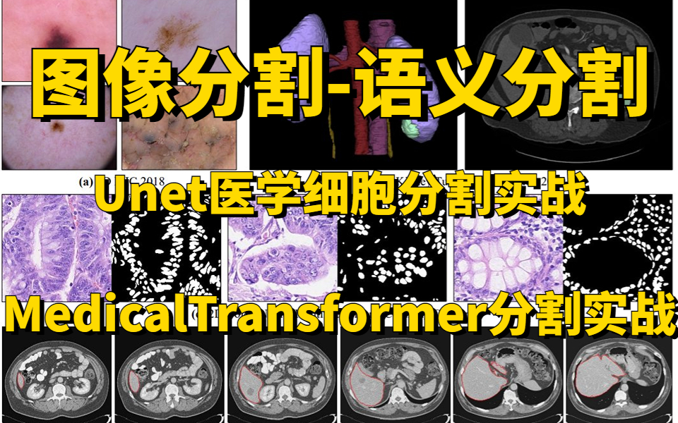 图像分割该从哪入手?最适合零基础的图像分割入门教程:内含医学分割、MedicalTransformer分割、deeplab系列算法等知识点讲解,赶紧收藏!哔哩哔哩...