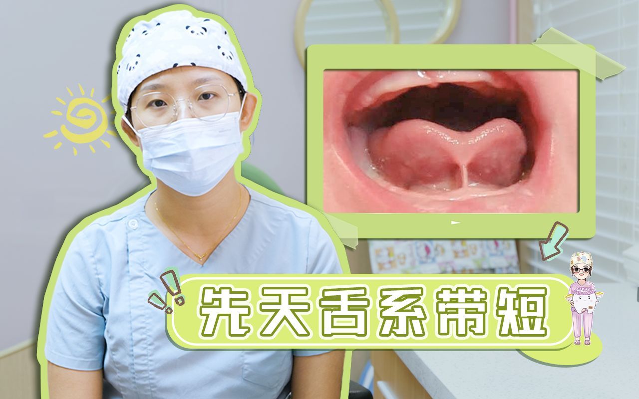 小孩子舌系带过短,为何也会加重地包天的形成