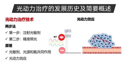 光动力治疗的发展历史及简要概述哔哩哔哩bilibili