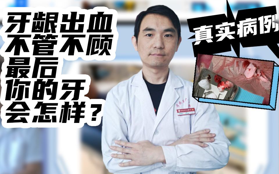 [图]【牙医揭秘】刷牙总出血？止血靠牙膏？一个关于牙龈出血的真相