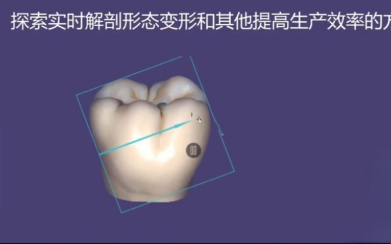 关于exocad探索实时解剖形态变形和其他提高生产效率的方法哔哩哔哩bilibili