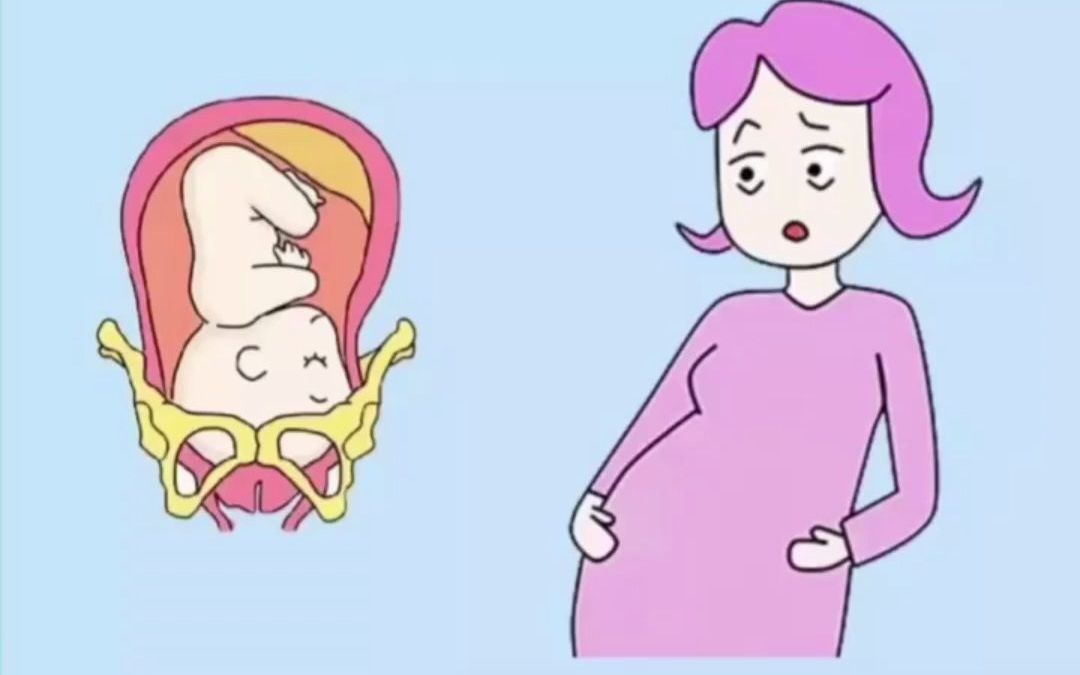 胎儿入盆孕妈有什么感觉?你有哪几种感觉?