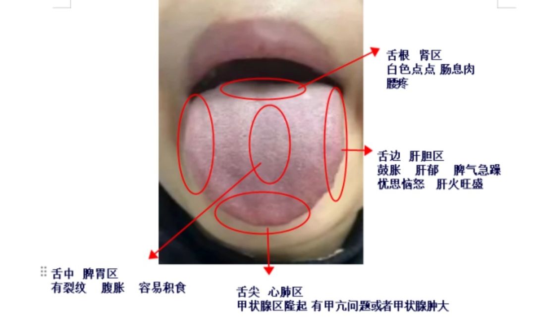 舌诊分析一脾胃虚弱,气血瘀阻,口干舌燥,阴虚内热,乏力无神!
