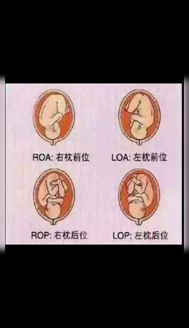 经常在直播间问老师胎位安排申庭老师