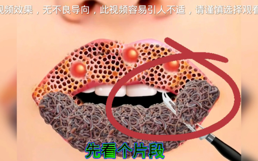新知识科普:密集恐惧症