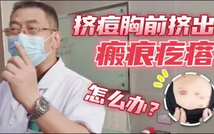 Download Video: 挤痘痘胸前挤出瘢痕疙瘩，怎么办？