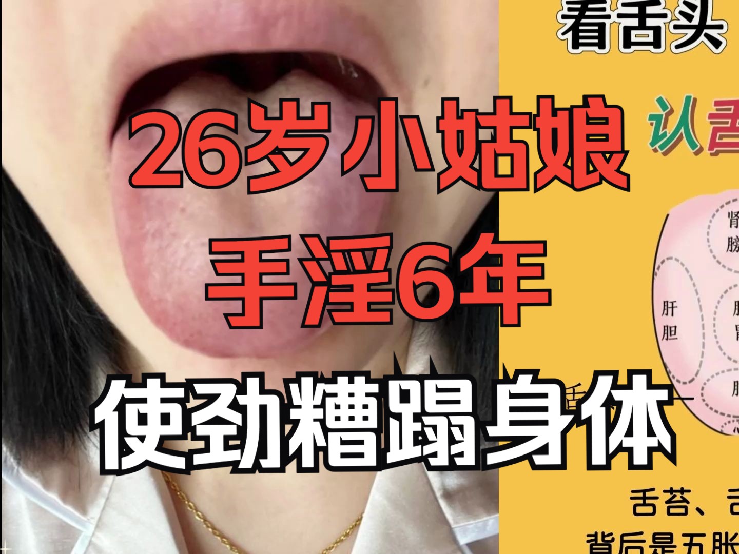 【舌诊分析】26岁小姑娘,频繁手淫喷水,不爱惜自己身体!!哔哩哔哩bilibili