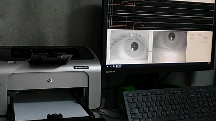 眼震电图仪图片