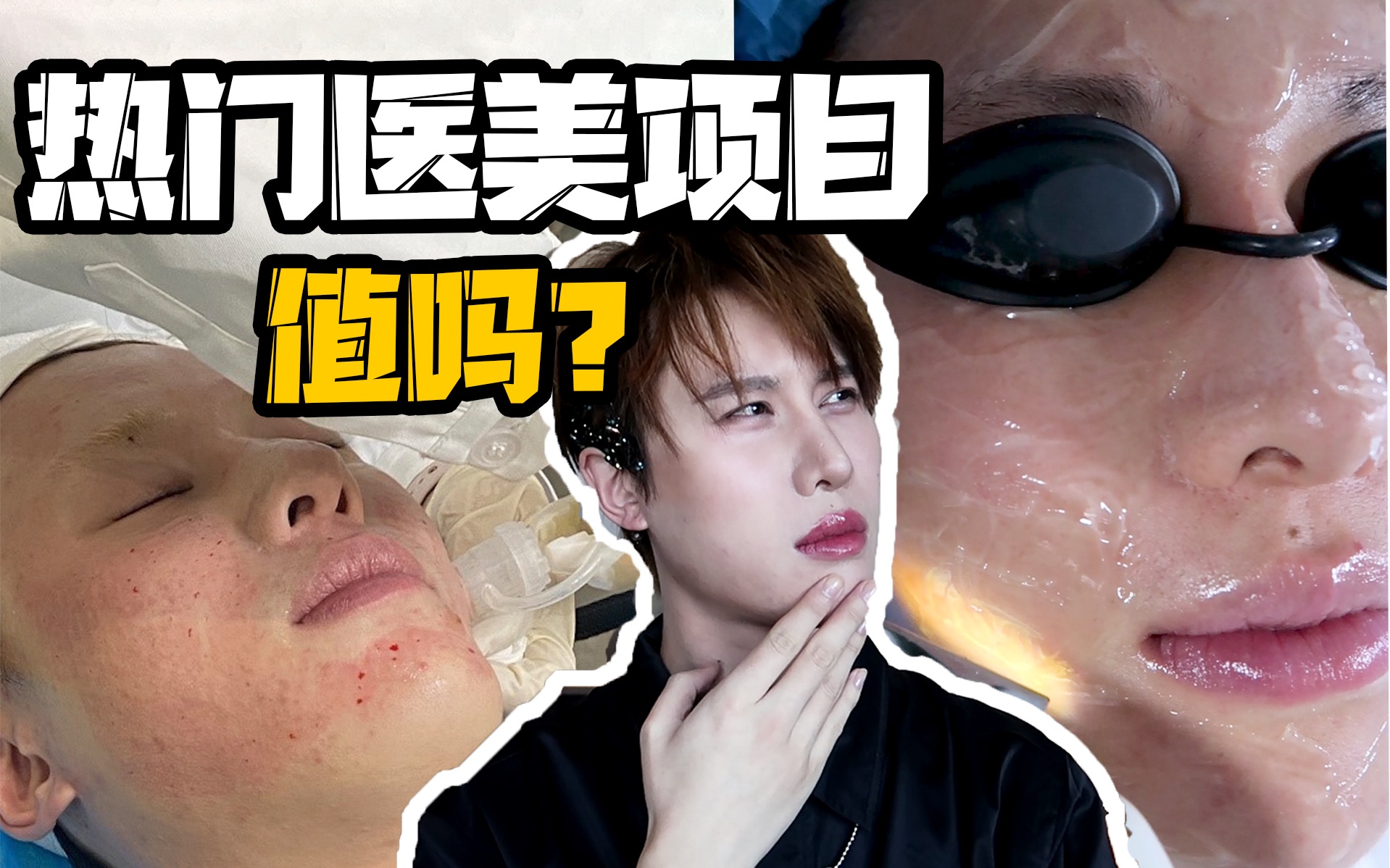 一年20万!真的值吗?热门医美项目全盘点|皮肤管理篇哔哩哔哩bilibili