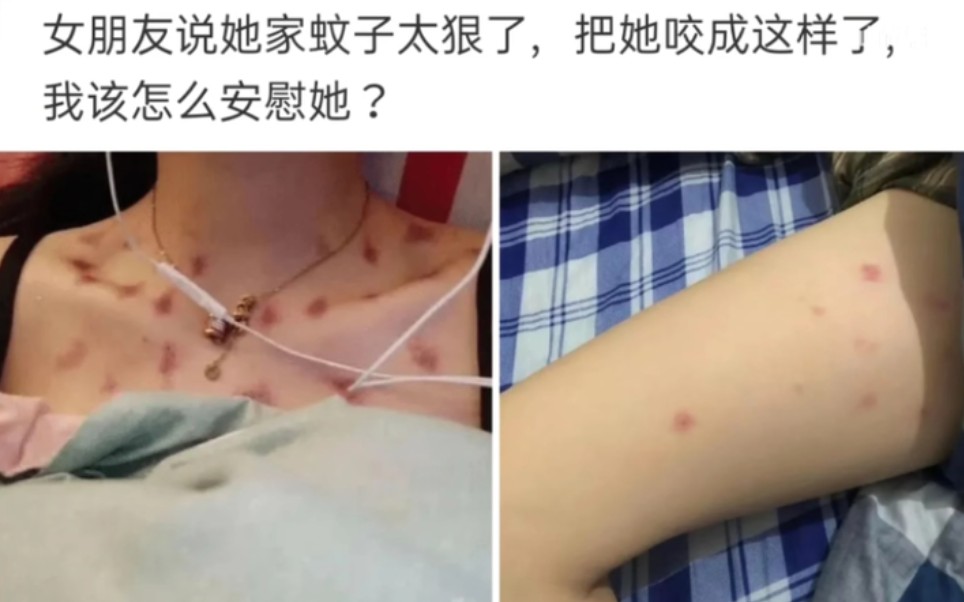 女朋友说她家蚊子太狠了,把她咬成这样了,我该怎么安慰她?今日份沙雕图已开启!哔哩哔哩bilibili