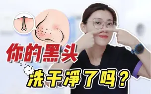 Download Video: 真心希望有黑头的同学都能刷到这条视频！