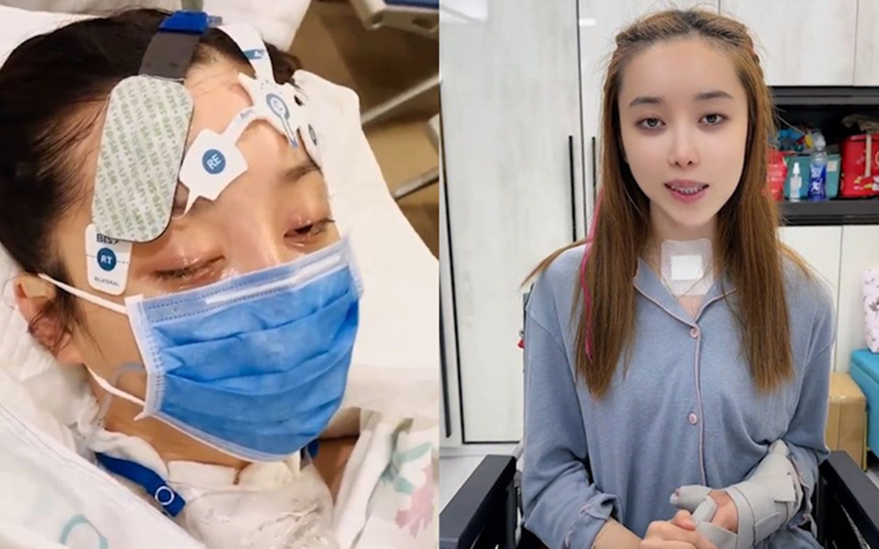 演员肖妍倪植物人苏醒后发声,否认整形过度导致昏迷,并自曝病因