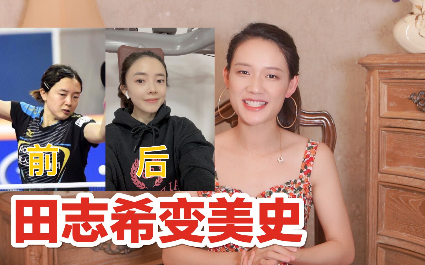 整形医生分析韩国女乒选手田志希的变美之路!